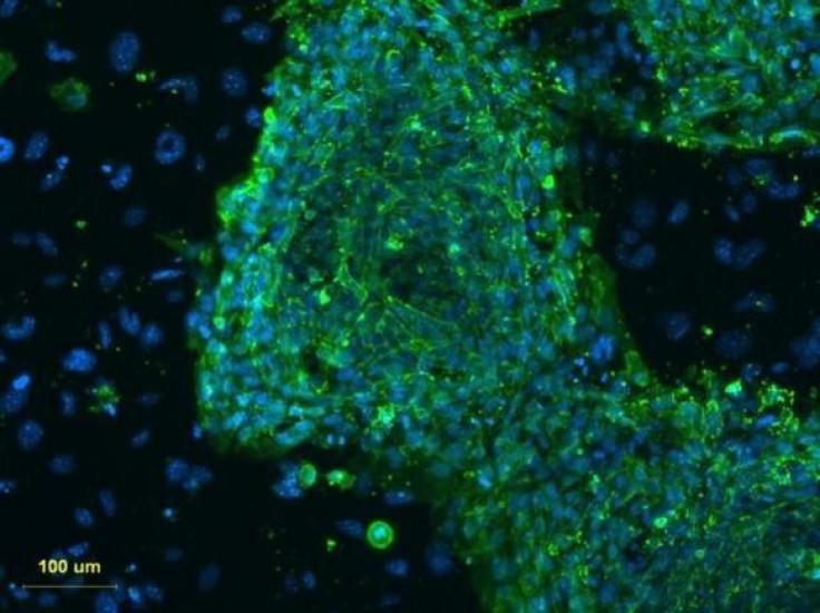 A fluorescent microscope image shows human embryonic stem cells in this photo taken at Stanford University and released by the California Institute for Regenerative Medicine, March 9, 2009.