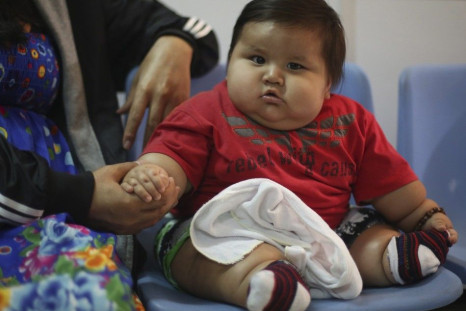Eight-month-old Santiago Mendoza sits at a clinic for the obese in Bogota March 19 ,2014. Mendoza, who weighs 20 kg, will be put on a diet, therapist Salvador Palacios said. REUTERS/John Vizcaino