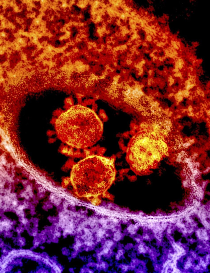 Particles of the Middle East respiratory syndrome (MERS) coronavirus that emerged in 2012 are seen in an undated colorized transmission electron micrograph from the National Institute for Allergy and Infectious Diseases (NIAID). 
