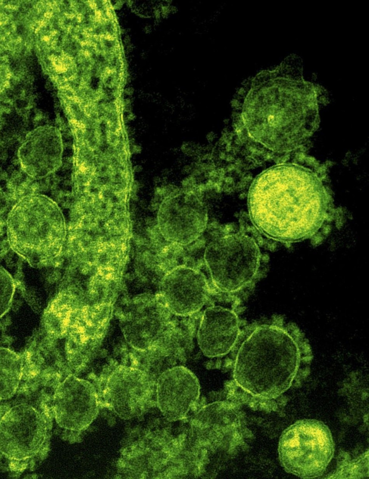 Handout Transmission Electron Micrograph Shows Particles of the Middle East Respiratory Syndrome (MERS) Coronavirus