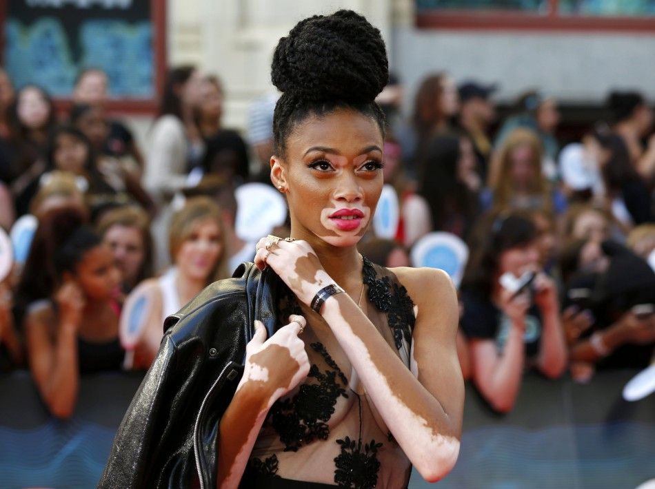 Model Winnie Harlow on the red carpet at the MuchMusic Video Awards MMVA in Toronto