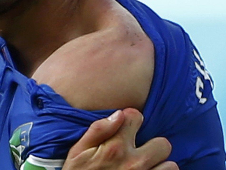 Italys Giorgio Chiellini shows his shoulder