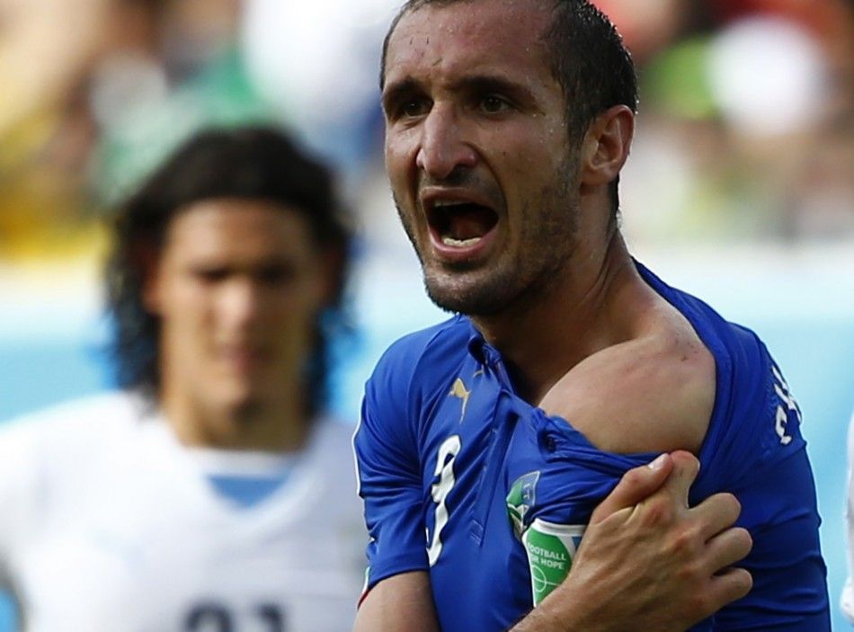 Italys Giorgio Chiellini shows his shoulder, saying he was bitten by Uruguays Luis Suarez, during their 2014 World Cup Group D soccer match at the Dunas arena in Natal in this June 24, 2014 file photo. Suarez has finally apologised for biting Chiellini 