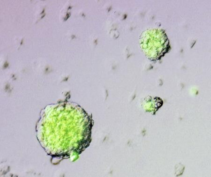 Stimulus-Triggered Acquisition of Pluripotency (STAP) cells are seen in this undated image released by RIKEN Center for Developmental Biology on January 28, 2014.