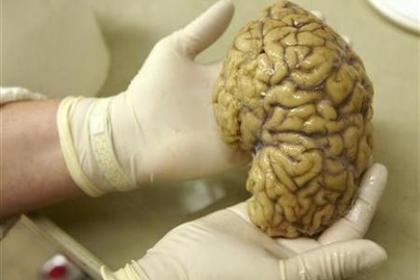 A laboratory assistant holds one hemisphere of a healthy brain