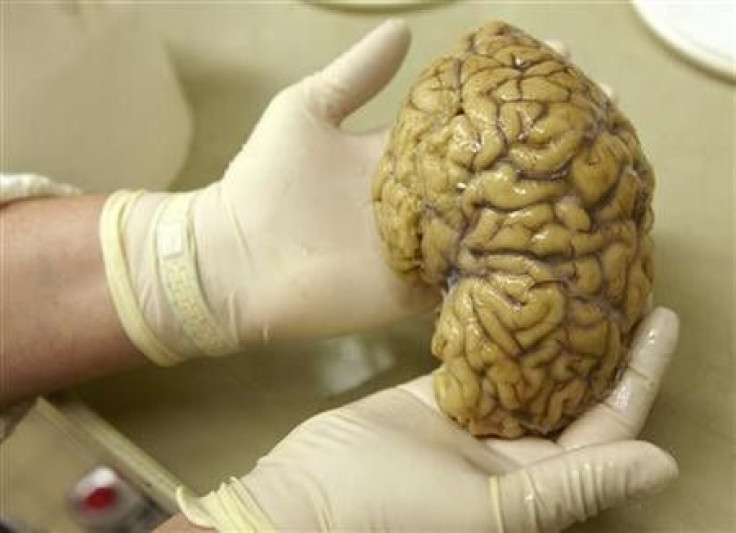 A laboratory assistant holds one hemisphere of a healthy brain