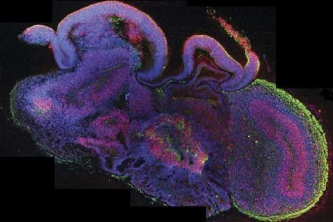 A cross-section of an entire organoid showing development of different brain regions is seen in this photo provided by the Institute for Molecular Biotechnology (IMBA) on August 29, 2013.