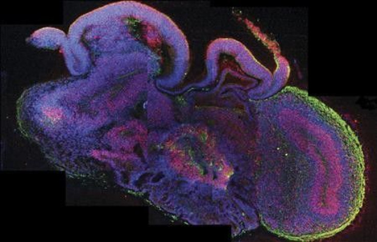 A cross-section of an entire organoid showing development of different brain regions is seen in this photo provided by the Institute for Molecular Biotechnology (IMBA) on August 29, 2013.