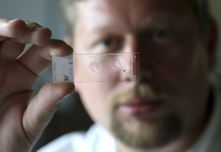 Belgian researcher Pierre Sonveaux poses with a sample of sliced mouse lung which contains a tumour at the University of Louvain&#039;s Insitute of Experimental and Clinical Research in Brussels July 31, 2014. REUTERS/Francois Lenoir