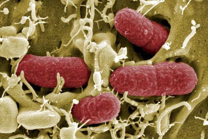 Brunswick, GermanyAn undated file picture taken with electronic microscope shows EHEC bacteria (enterohaemorrhagic Escherichia coli) in Helmholtz Centre for Infection Research in Brunswick. German health authorities on May 25, 2011 have warned consumers t