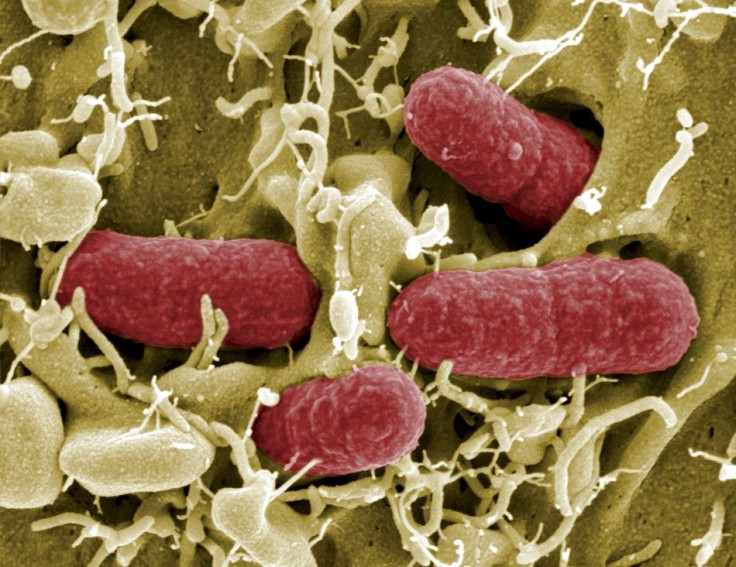 Brunswick, GermanyAn undated file picture taken with electronic microscope shows EHEC bacteria (enterohaemorrhagic Escherichia coli) in Helmholtz Centre for Infection Research in Brunswick. German health authorities on May 25, 2011 have warned consumers t
