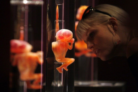 A visitor looks at a foetus that died before it was born during &quot;Bodies: The Exhibition&quot;, an international exhibition, by Gunther Von Hagens in Lima June 24, 2009.