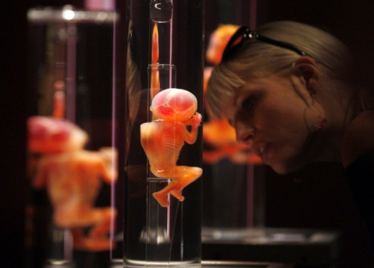 A visitor looks at a foetus that died before it was born during &quot;Bodies: The Exhibition&quot;, an international exhibition, by Gunther Von Hagens in Lima June 24, 2009.