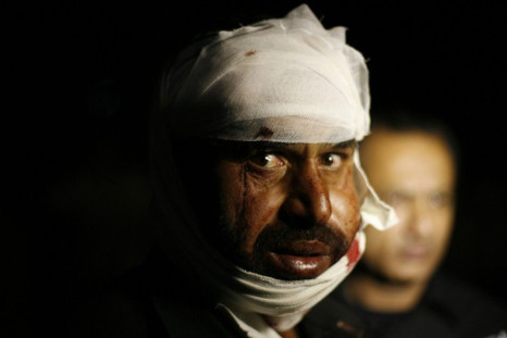 A Pakistani man wounded in a suicide bomb attack, reacts to the camera after received first aid in hospital in Wagah border, near Lahore