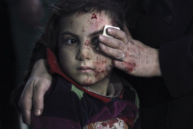 A mother holds a piece of gauze to the face of her injured daughter at a field hospital after what activists said were air strikes by forces loyal to Syria's President Bashar al-Assad in the Duma neighborhood of Damascus November 11, 2014.