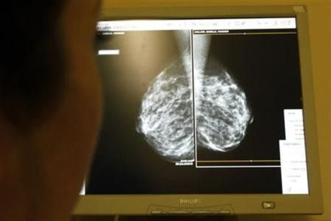 Detecting Breast Tumours Using Mammograms