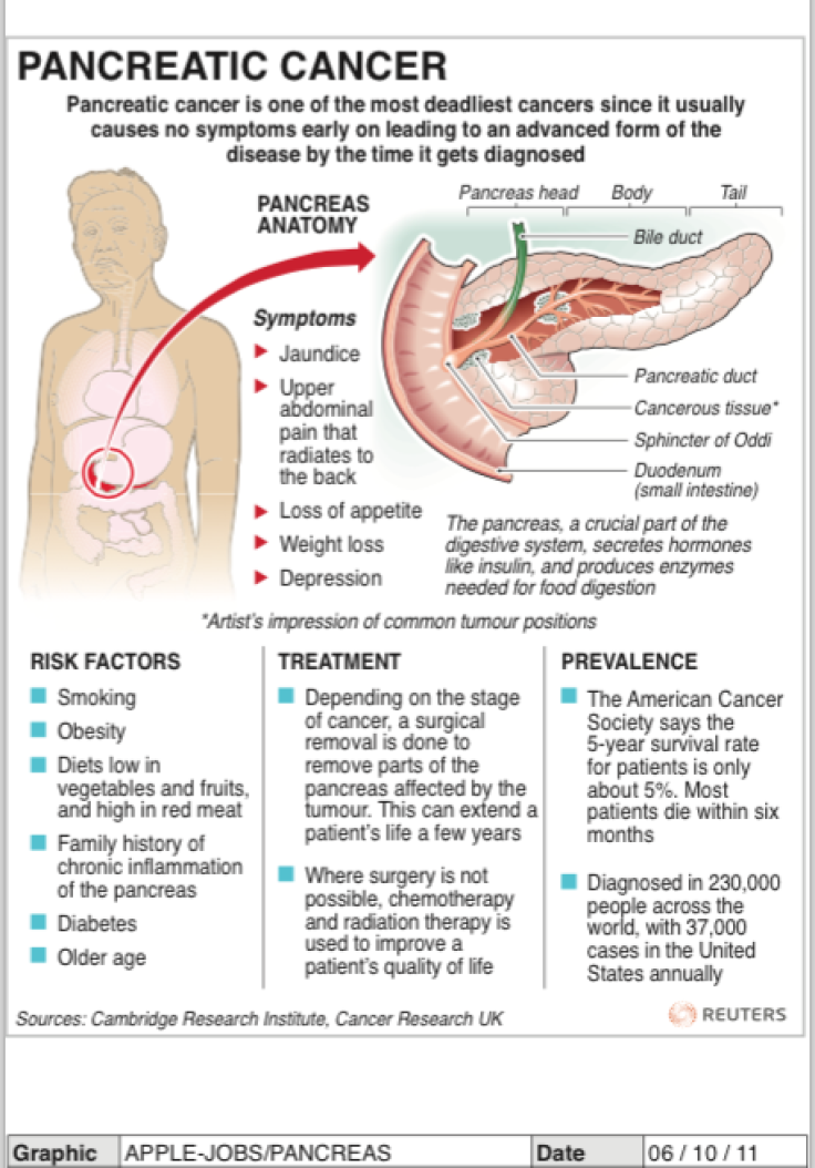 Diagram and factbox on the pancreas and pancreatic cancer. (SIN03)