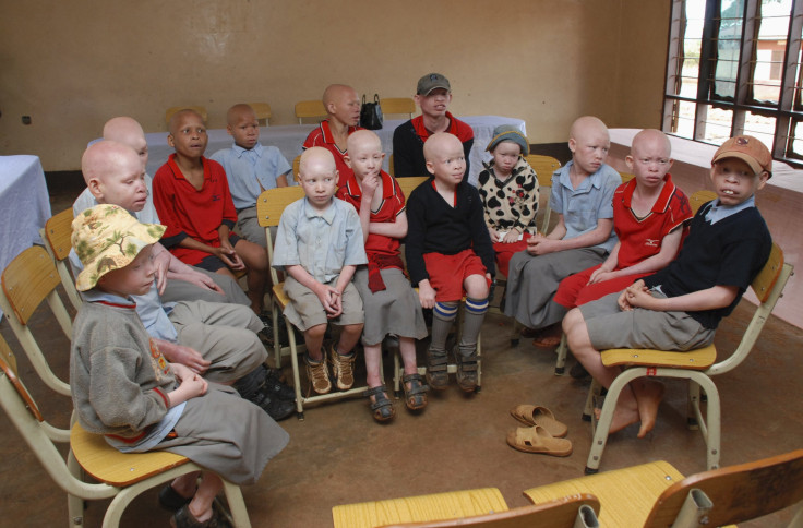 Albino Children