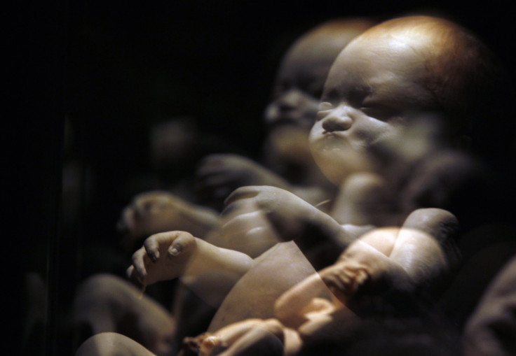 A fetus