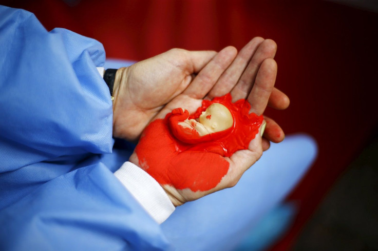 A woman holds a fake fetus during a rally against the draft law of the Chilean government which seeks to legalize abortion, in Santiago, March 23, 2015.