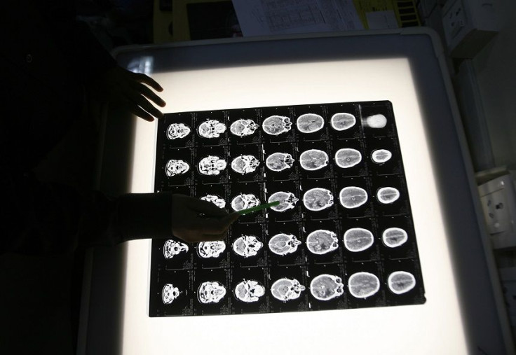 brain x-ray