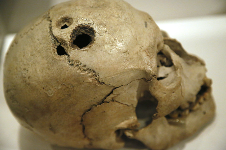 A human skull 