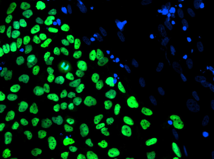 A human embryonic stem cell line 