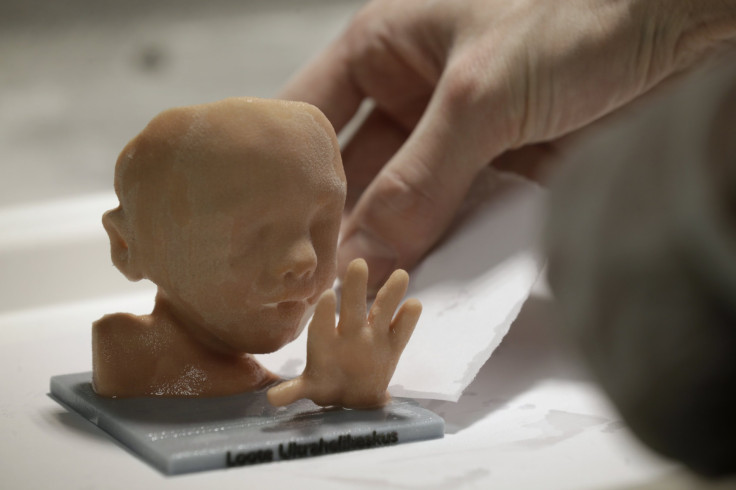 3D-Printed Ultrasound Lets Blind Mother-To-Be "See" Her Unborn Baby