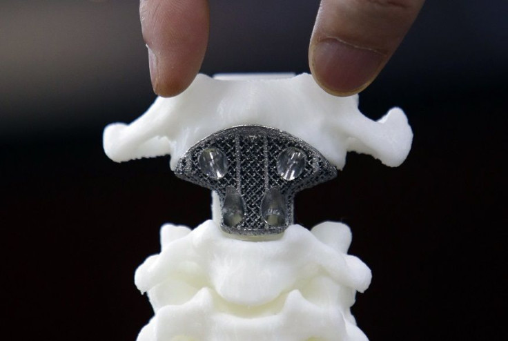 A spine model implanted with a 3D-printed artificial axis