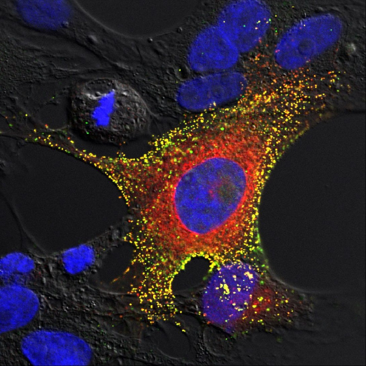 Bat cells Hendra infected