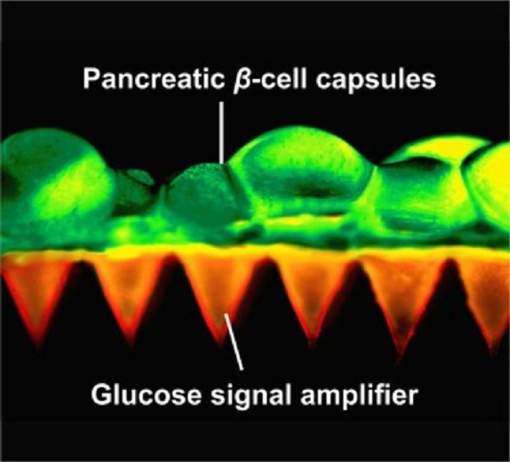 Glucose Signal Amplifier