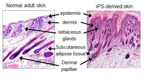 Artificial Skin 1