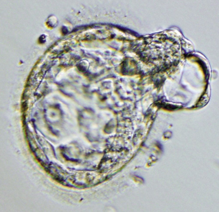 Embryo