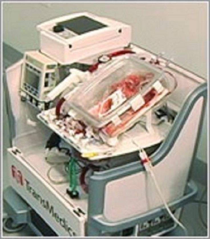Heart Perfusion and Monitoring System