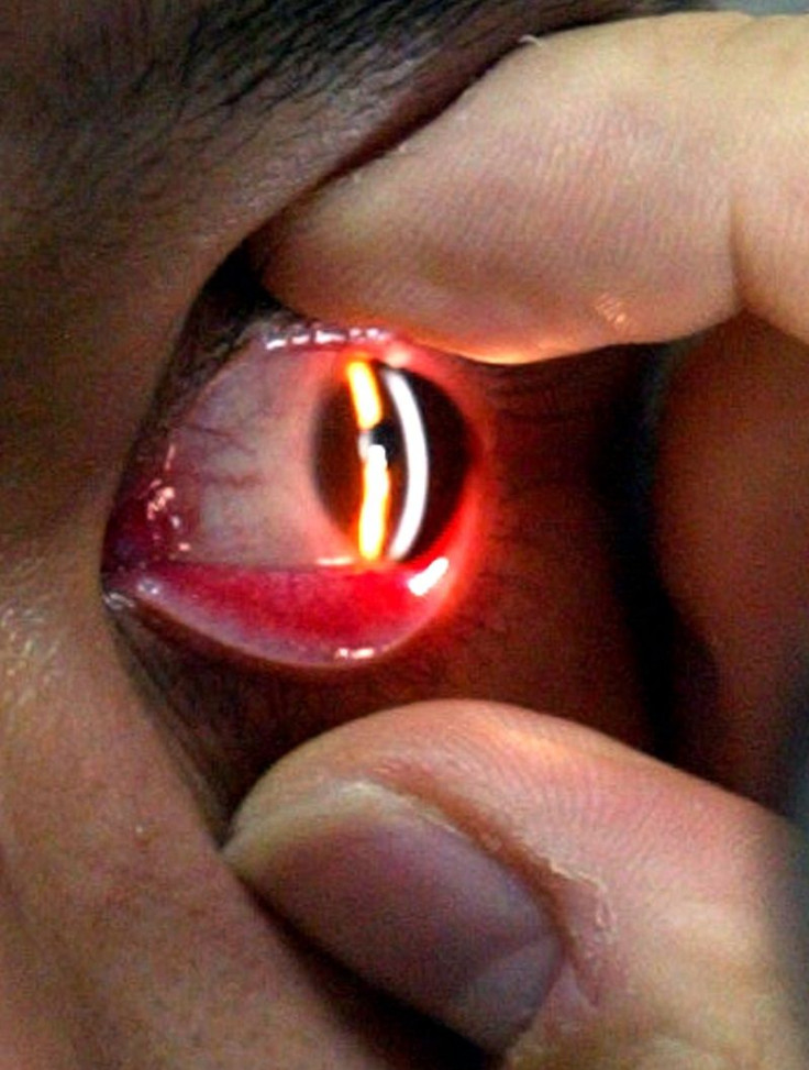 A South Korean patient receives treatment at an ophthalmological clinic in Seoul September 6, 2002.