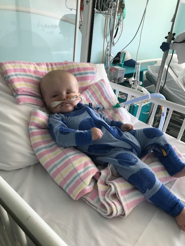 Ten-month-old Archie Innes was born without eyes