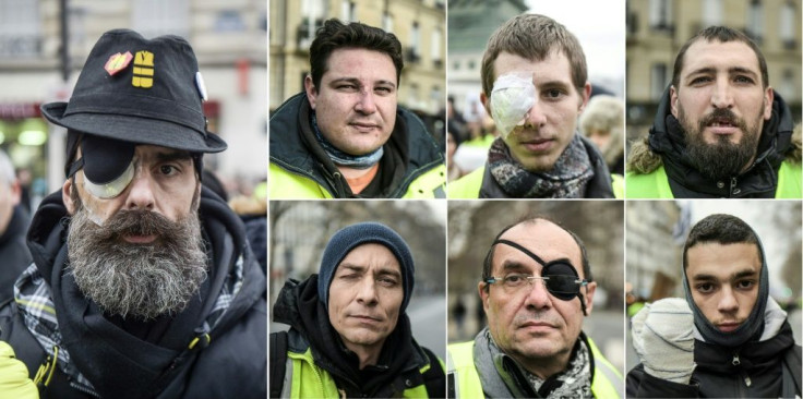 Scores of yellow vest protesters were maimed by rubber bullets or stun grenades, some losing an eye or a hand