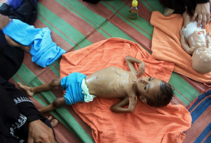 Tens of thousands of people have been killed and millions pushed to the brink of famine in the six-year-old Yemen conflict, which the UN describes as the world's worst humanitarian crisis