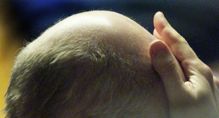 Researchers found a potential cause for baldness that could lead to an effective drug in five years, according to a new study.