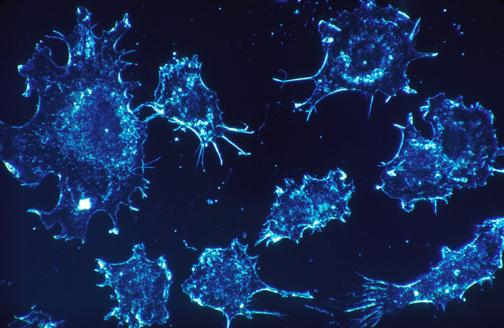 Cancer cells survive because of a protein