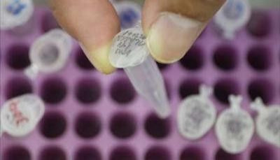 DNA sample