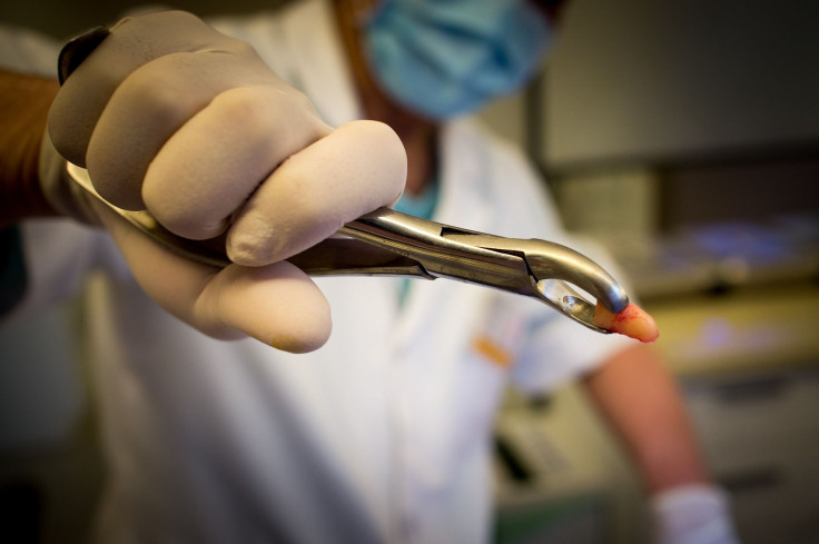 Representation. A dentist showing off a pulled tooth.