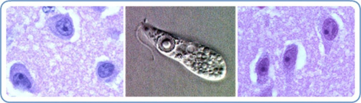The Louisiana Department of Health & Hospitals recently issued a warning about the potential dangers of improper neti pot use, following the death of two local residents from so-called "brain-eating amoeba."