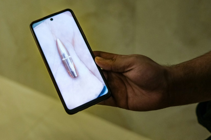 A nurse shows a picture of a bullet found at the Ibn Sina hospital