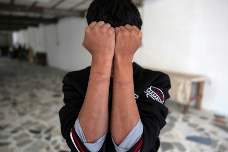 A man at a shelter in northern Mexico shows the scars left by ropes used by a cartel to tie him up
