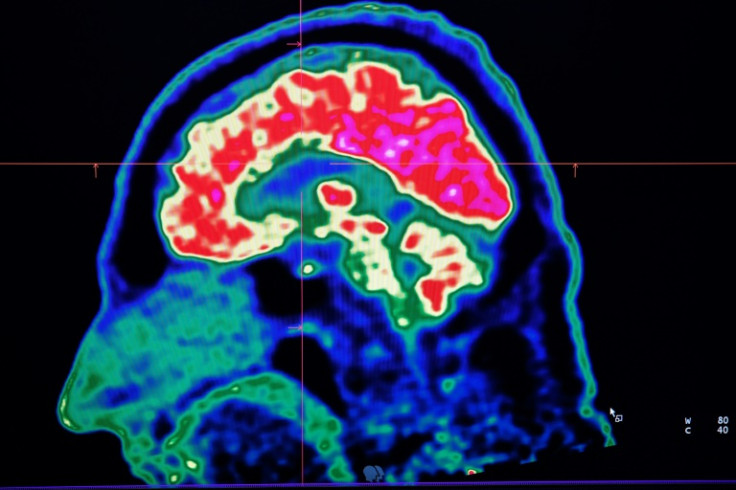 Microplastics are everywhere, but data is still lacking about how they could be affecting our brains