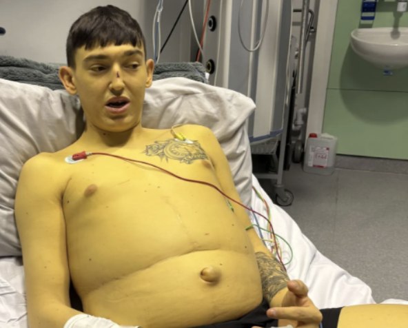 British Man Says Rare Liver Disease Turned His Skin Yellow 